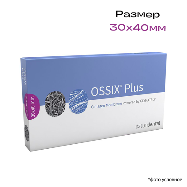 Изображение Мембрана коллагеновая OSSIX® Plus, малый размер 30x40мм, 1шт.